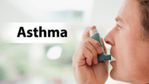 Forskolin and Asthma Prevention